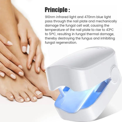 Toe & Fingernail Blue Light Fungal Treatment Device
