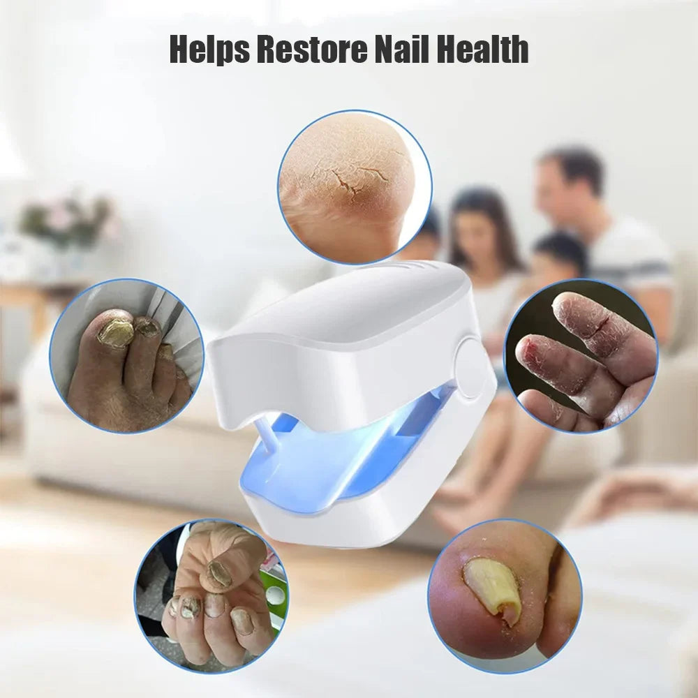 Toe & Fingernail Blue Light Fungal Treatment Device