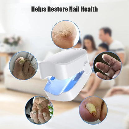Toe & Fingernail Blue Light Fungal Treatment Device