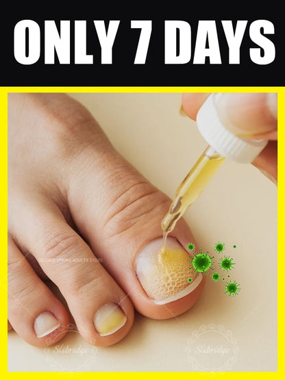 manicure for bad Can in 7 days farewell