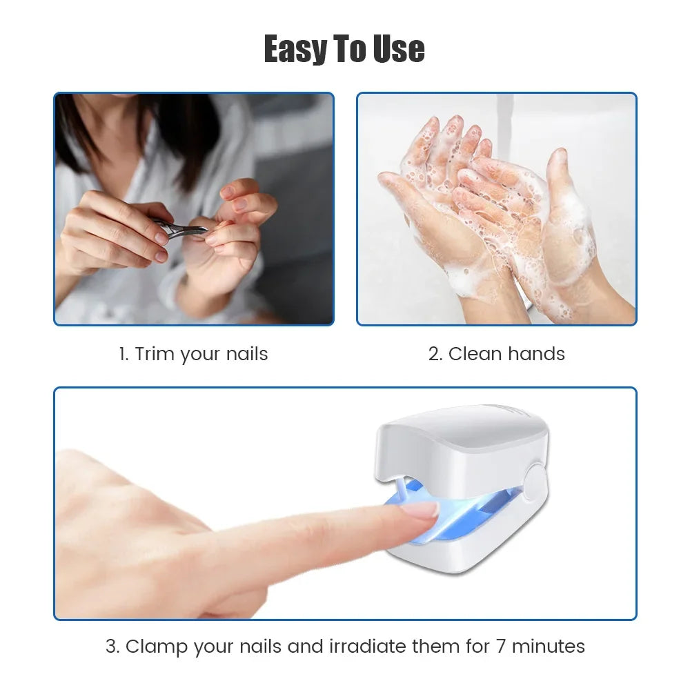 Toe & Fingernail Blue Light Fungal Treatment Device