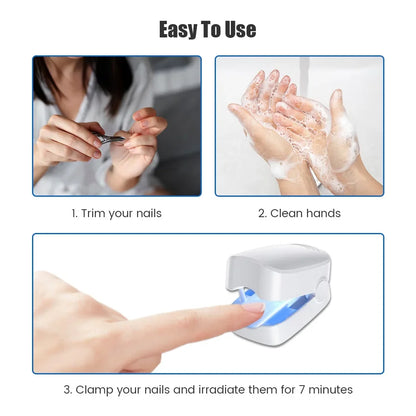 Toe & Fingernail Blue Light Fungal Treatment Device