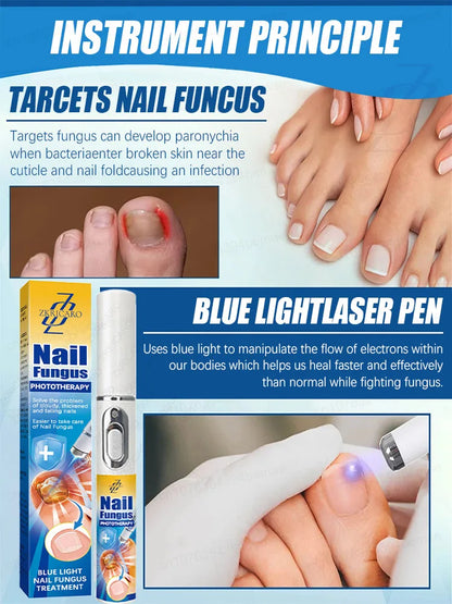 Blue Light Fungal Nail Treatment Pen
